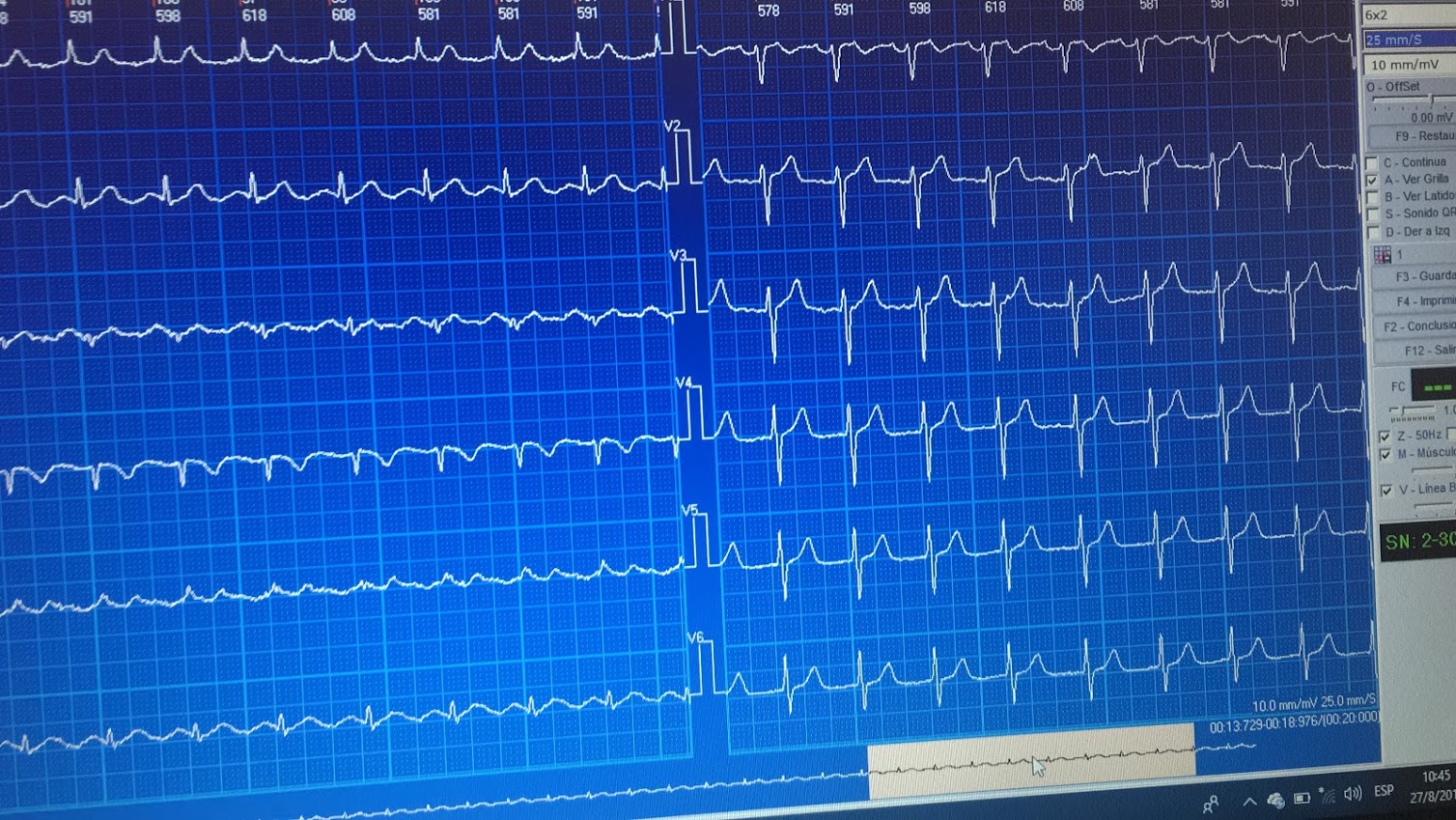 PROXIMAMENTE | CardioTrivia
