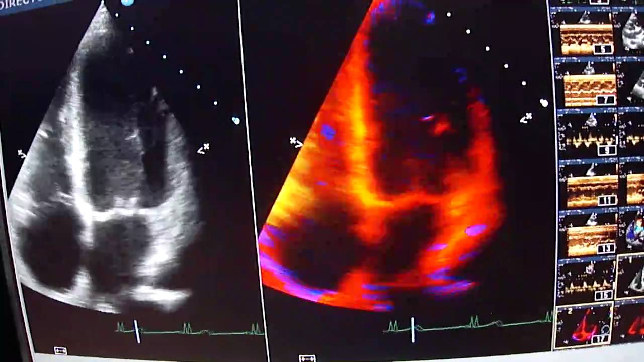 PROXIMAMENTE | Sube tu estudio